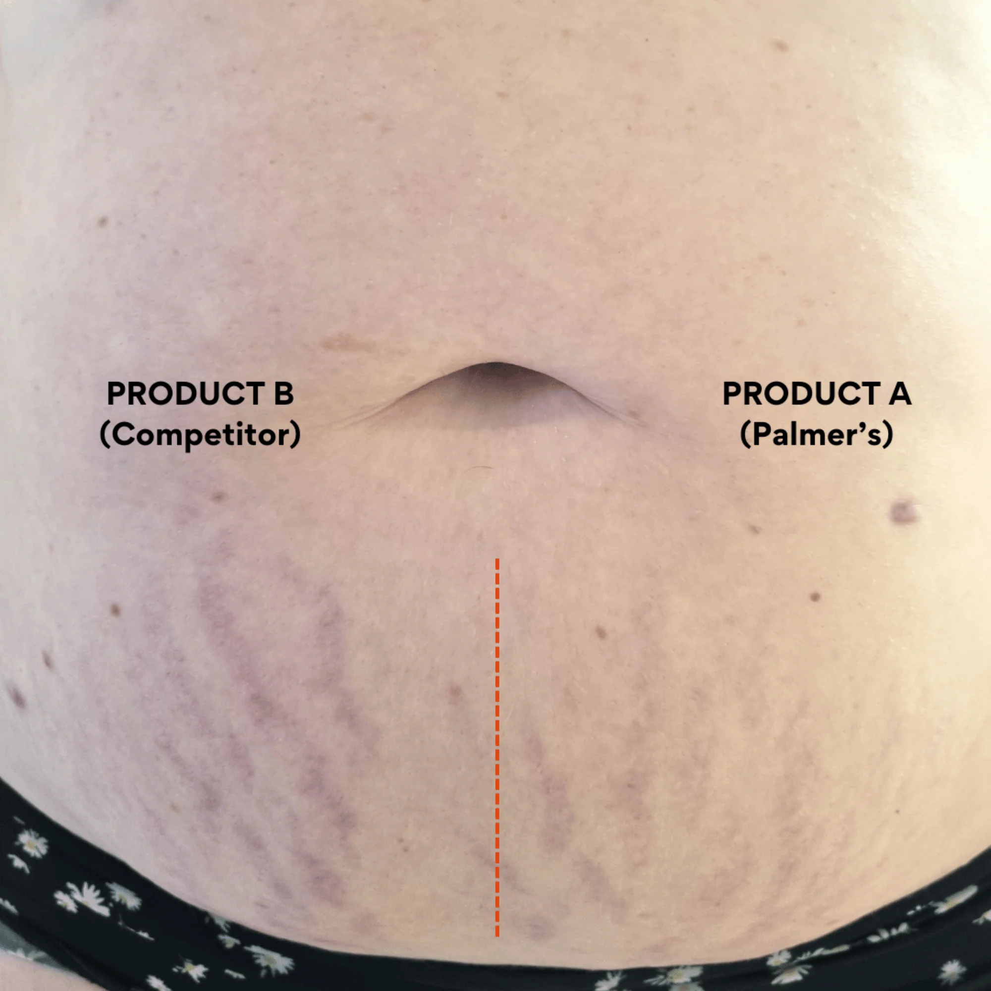 Palmer's Massage Lotion for Stretch Marks 250ml - Image 6