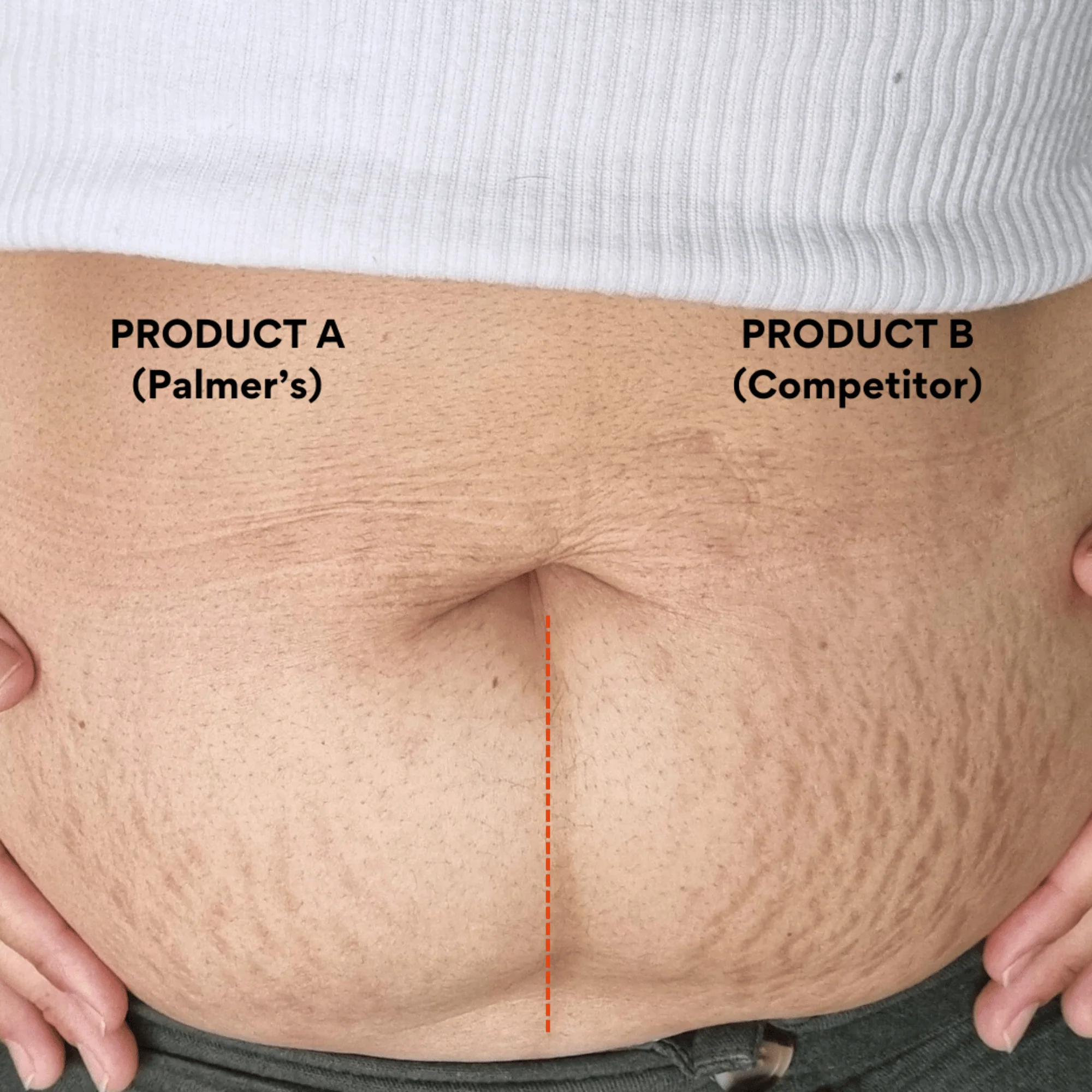 Palmer's Massage Lotion for Stretch Marks 250ml - Image 7