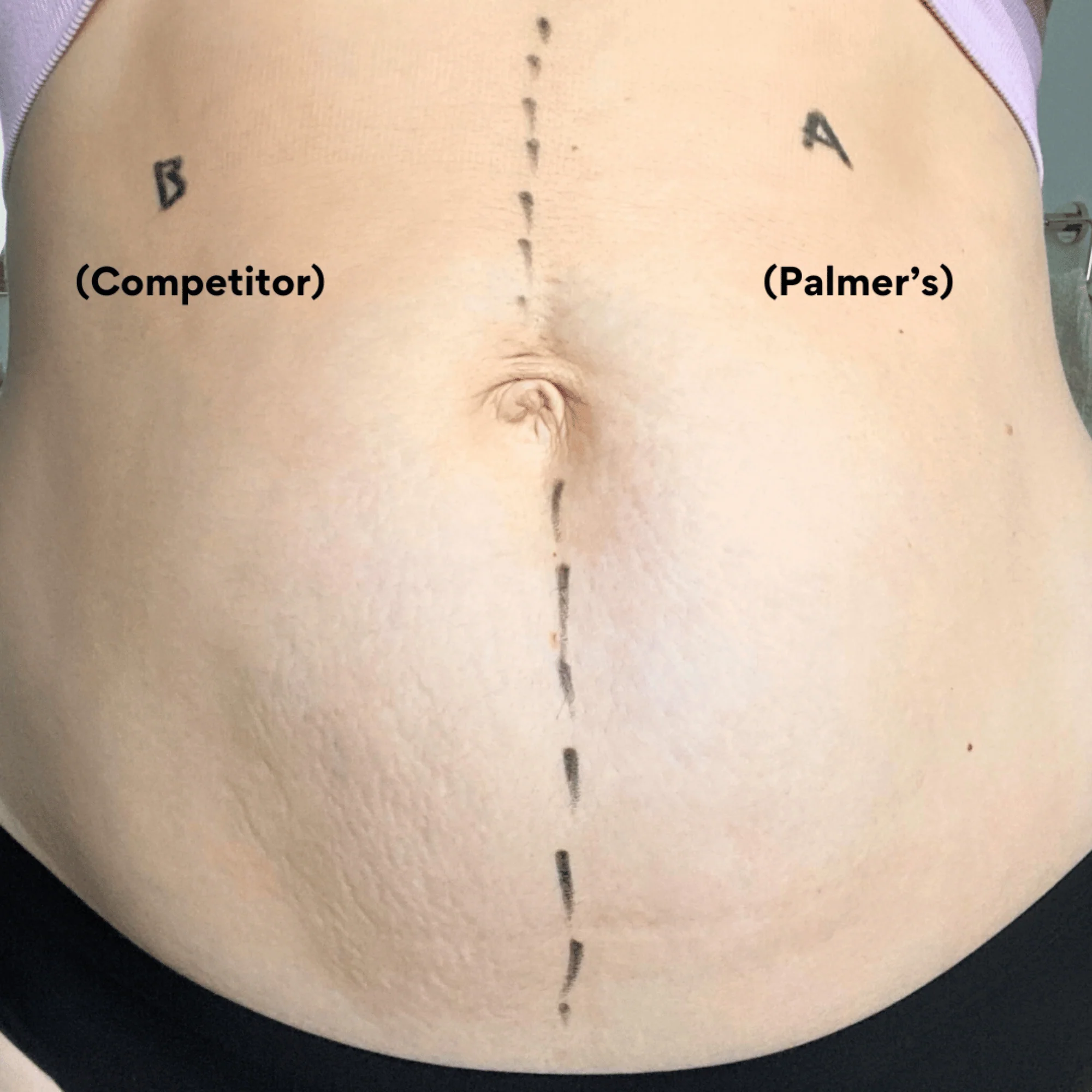 Palmer's Massage Lotion for Stretch Marks 250ml - Image 8