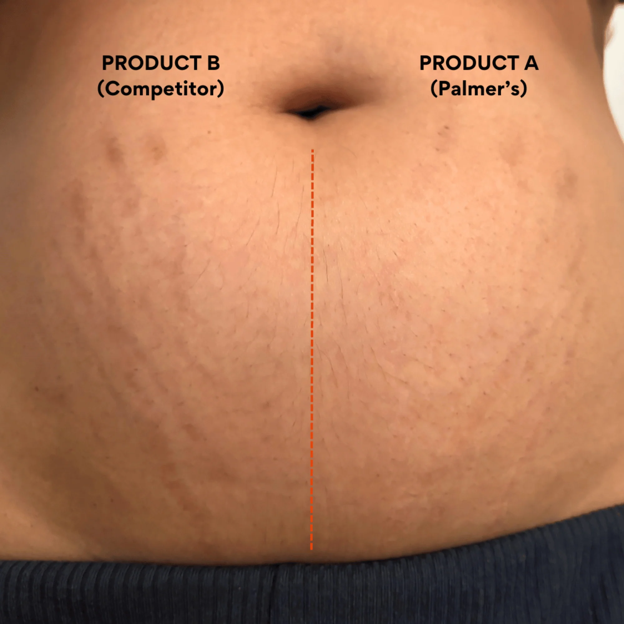 Palmer's Massage Lotion for Stretch Marks 250ml - Image 9